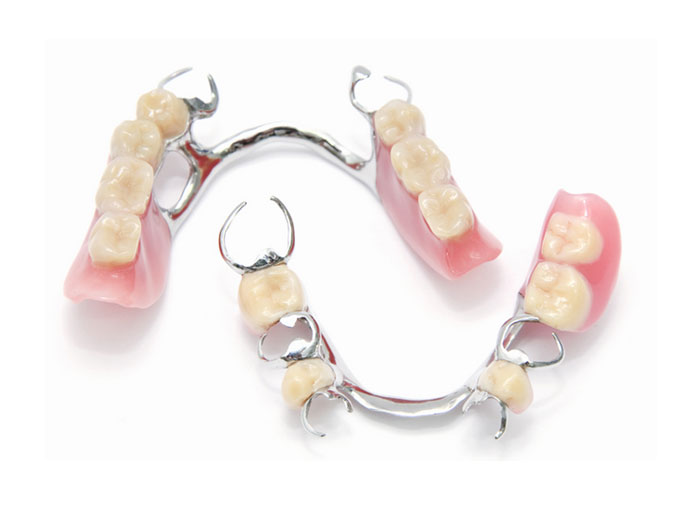 Esquelético Clínica Dental Ribes Altea