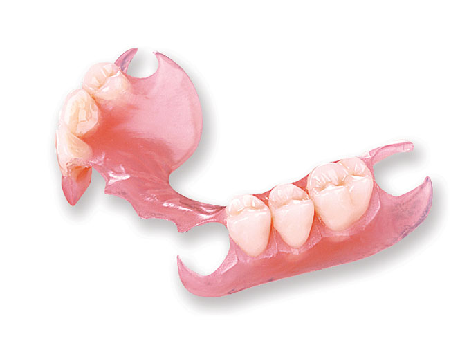 Prótesis Parcial Removible Clínica Dental Ribes Altea
